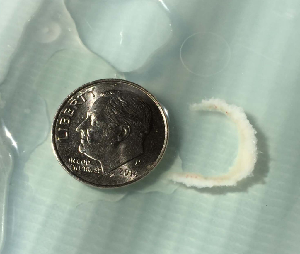 Morgellons disease photo : Another keratin shard